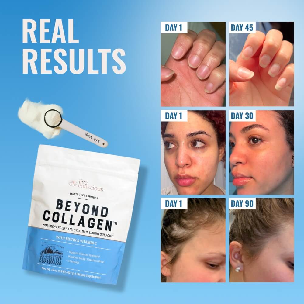 Beyond Collagen® - Image 3